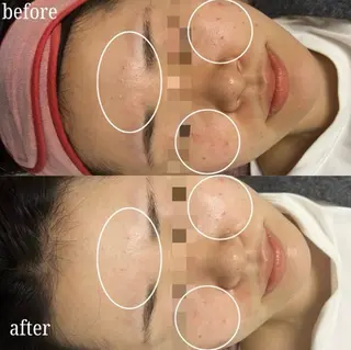 看護師が施術する美容 ナスサロ/川口のエステ・リラクイメージ