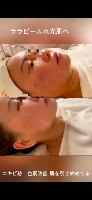 M 🌱naturalのエステ・リラクイメージ