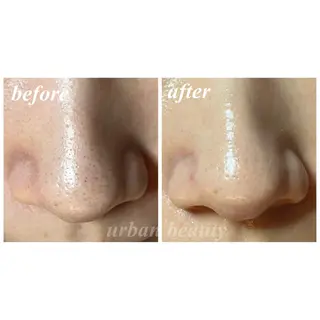 結果重視｜毛穴エステ ｜友綱理恵のエステ・リラクイメージ