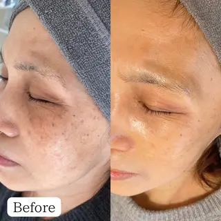 シミケア専門店 &Moreのエステ・リラクイメージ