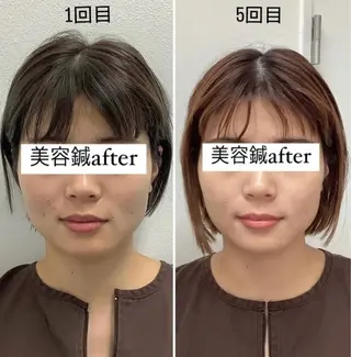 美容鍼灸×小顔整体♡ ハリサロンドオフ堺東のその他イメージ