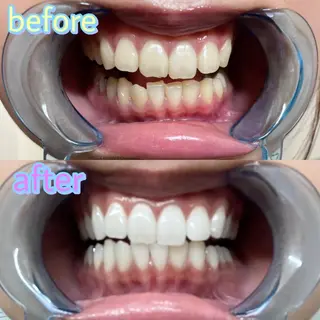 ホワイトニング専門店 LCS 新橋店 佐藤のその他イメージ