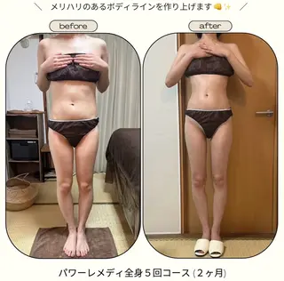 《本気痩せ×疲労改善 》  BILOOPのエステ・リラクイメージ
