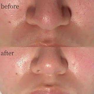 Erika komorebi_のエステ・リラクイメージ