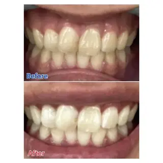 Ｍ渋谷 ホワイトニングのエステ・リラクイメージ