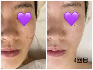 COCO beautyサロンのエステ・リラクイメージ