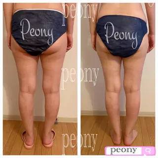 デトックス美容専門 サロンpeonyのエステ・リラクイメージ