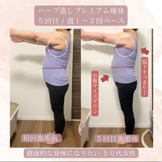 ハーブ蒸し小顔矯正 サロンLinoのエステ・リラクイメージ