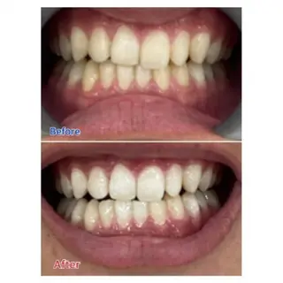 Ｍ渋谷 ホワイトニングのエステ・リラクイメージ