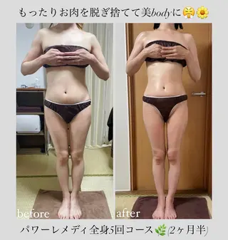 《本気痩せ×疲労改善 》  BILOOPのエステ・リラクイメージ
