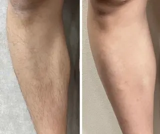 メンズ MEN‘S CARE メンズ脱毛サロンのエステ・リラクイメージ