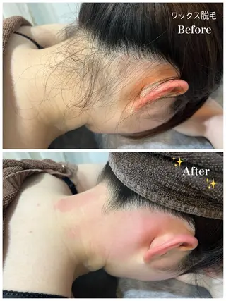 脱毛サロン fam.豊澤柚良のエステ・リラクイメージ