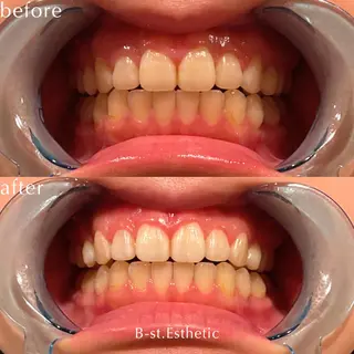 B-st. 下北沢のその他イメージ