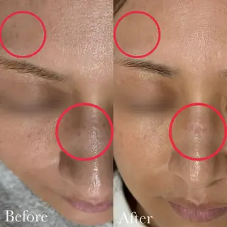 美容鍼脱毛salon リノン吹田駅前店のエステ・リラクイメージ