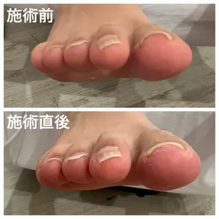 ネイル S Mihoのネイルデザイン