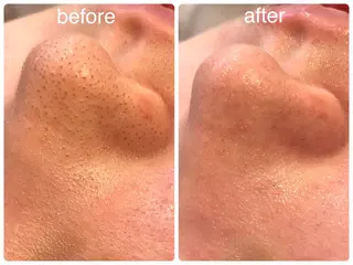 Hisui 小出のエステ・リラクイメージ