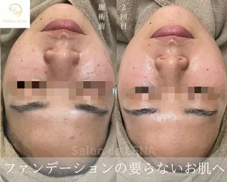 ハーブピーリング専門 サロンドレナ　白藤のエステ・リラクイメージ