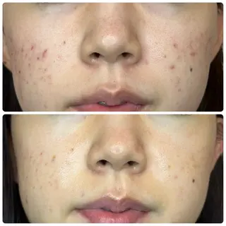 ROUN'　南 鈴沙のネイルデザイン