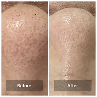 bonuru salonのエステ・リラクイメージ