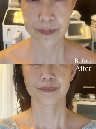 クリニカルサロン　ルミライ所属・看護師 島森のエステ・リラクイメージ