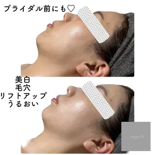 marron所属・痩身ハイパーナイフ ララピールリアボーテのエステ・リラクイメージ