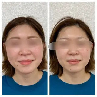 小顔矯正サロン Lilyのエステ・リラクイメージ