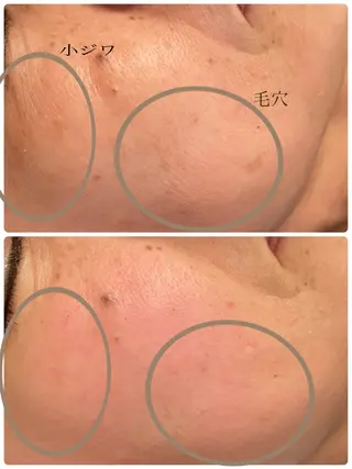 Lumiere by SERIKA.所属・稲角 芹香のエステ・リラクイメージ