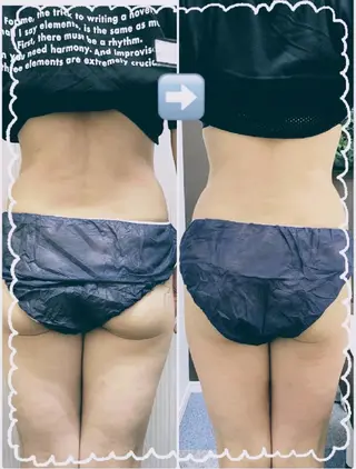 サポート 鍼灸整骨院のエステ・リラクイメージ