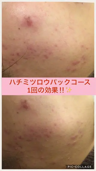 ショート カラー ヘアアレンジ メンズ キッズ ネイル マツエク・マツパ ニキビ・肌質改善専門 ♡人生が変わるサロンのエステ・リラクイメージ