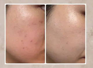 Vi's CLUB KOTONOのエステ・リラクイメージ