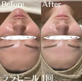 中目黒ハーブピーリン グ🌿ララピールのエステ・リラクイメージ