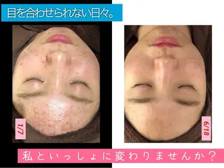 セミロング カラー パーマ ヘアアレンジ メンズ キッズ ネイル マツエク・マツパ 金の糸脱毛 産毛ケア専門のエステ・リラクイメージ
