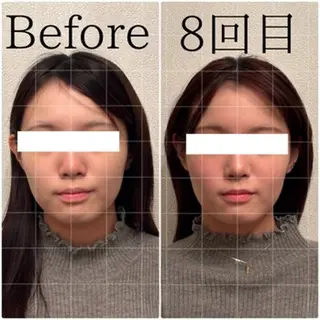 Lily luce 美骨小顔矯正のその他イメージ