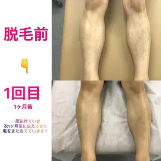 メンズ メンズ脱毛サロン ／金山昌弘のエステ・リラクイメージ