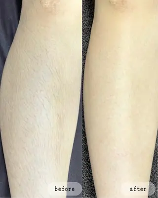 LaVibe ann.のエステ・リラクイメージ