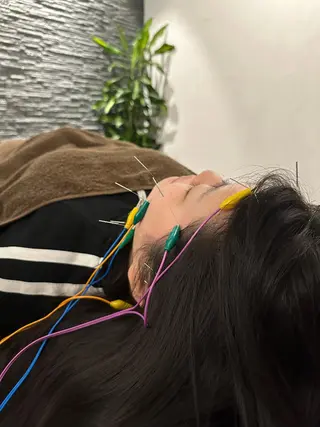 小顔矯/美容鍼/鍼灸 BeauJuのその他イメージ