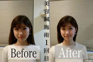 鍼灸 Refineのその他イメージ