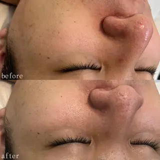 肌質改善サロン🫧 MAIのエステ・リラクイメージ