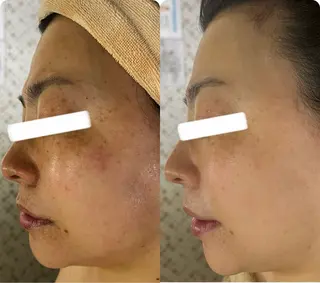 小顔&美肌品川店 Masqueradeのエステ・リラクイメージ