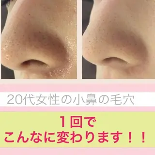 ミディアム カラー パーマ ヘアアレンジ メンズ キッズ ネイル マツエク・マツパ ニキビ・肌質改善専門 ♡人生が変わるサロンのエステ・リラクイメージ