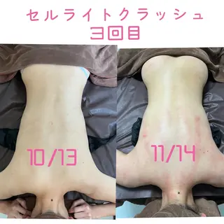 LUANA所属・ma ruのエステ・リラクイメージ