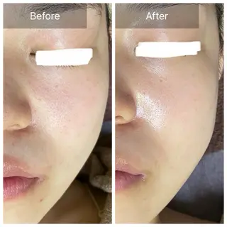 バフトアップ/ハーブ Nornのエステ・リラクイメージ