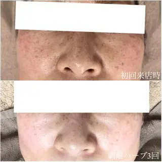 毛穴/毛穴洗浄専門 エミルカ船橋のエステ・リラクイメージ