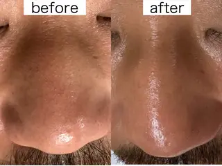 医療提携Beauty SalonMuseのエステ・リラクイメージ