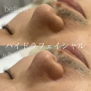 フェイシャルサロン CHIARA 荒田のエステ・リラクイメージ