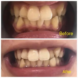 M渋谷 ホワイトニングのエステ・リラクイメージ