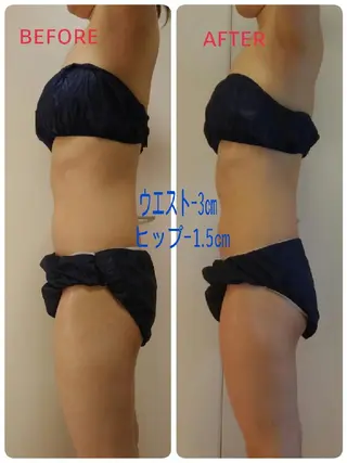 リンパサロン レディ ワンのエステ・リラクイメージ