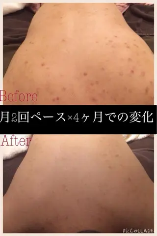 ミディアム カラー パーマ ヘアアレンジ メンズ キッズ ネイル マツエク・マツパ ニキビ・肌質改善専門 ♡人生が変わるサロンのエステ・リラクイメージ