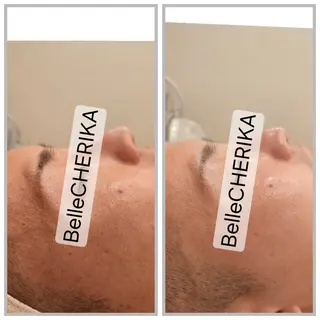 ベル チェリカ 三城のエステ・リラクイメージ