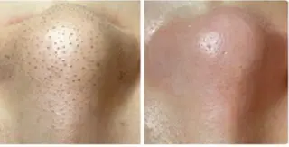 beauty salonN.11のエステ・リラクイメージ